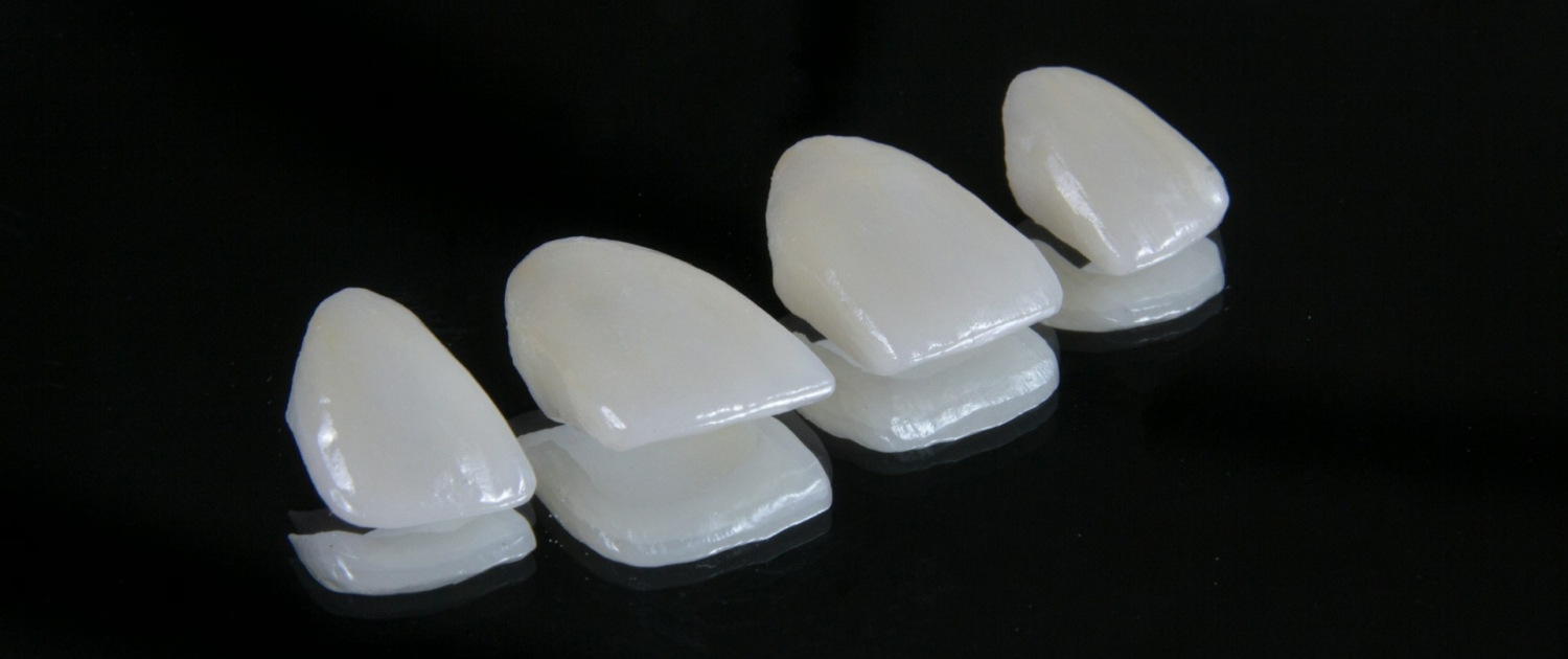 ozkan-guner-WvVW7mRaZE8-unsplash